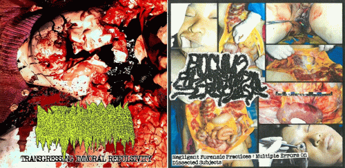 Cystic Hygroma : Cystic Hygroma - Bioculus Phlyctaenulosial Scrofulosa